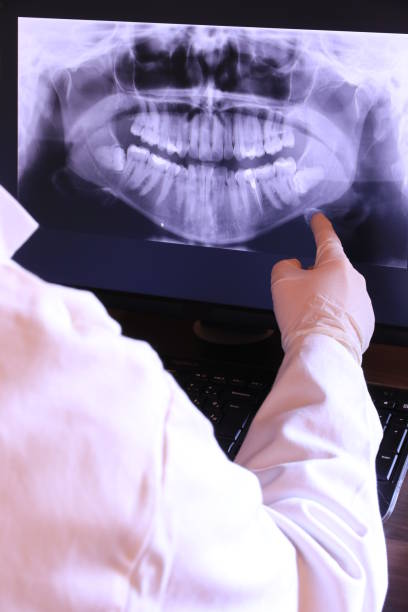 Best Emergency Tooth Extraction  in Wytheville, VA